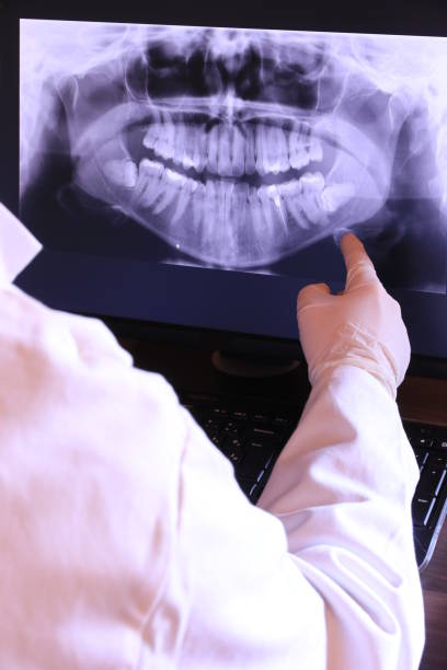 Best Emergency Tooth Extraction in Sheffield, OH